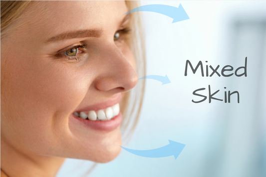 ¿Tienes la piel mixta? Aprende a cuidarla correctamente